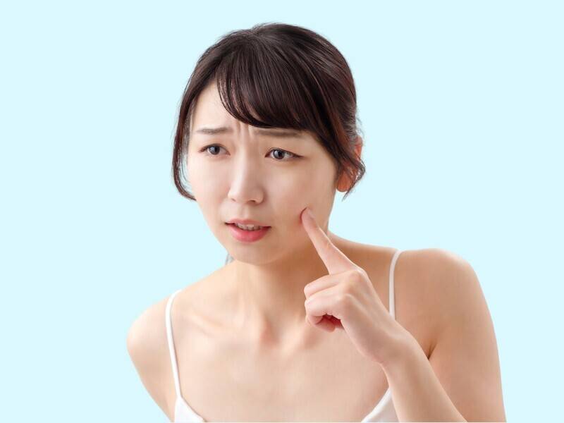 肌荒れ